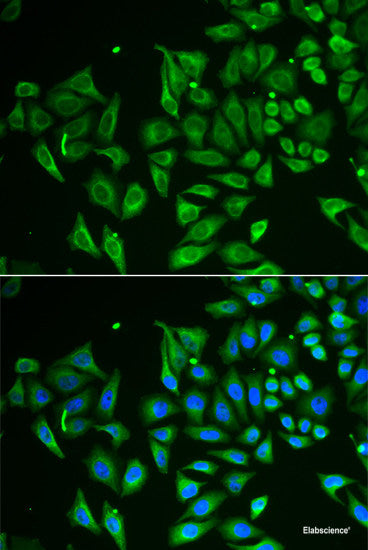 Immunohistochemistry of paraffin-embedded Rat kidney using DDX41 Polyclonal Antibody at dilution of 1:100 (40x lens).