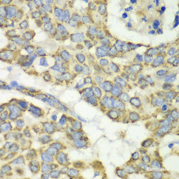 Immunofluorescence analysis of U2OS cells using EIF5 Polyclonal Antibody