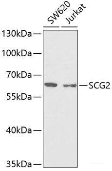 Immunohistochemistry of paraffin-embedded Human tonsil using FCN1 Polyclonal Antibody at dilution of 1:100 (40x lens).