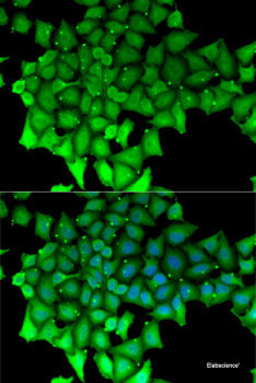 Western blot analysis of extracts of MCF-7 cells using GABBR2 Polyclonal Antibody at dilution of 1:1000.