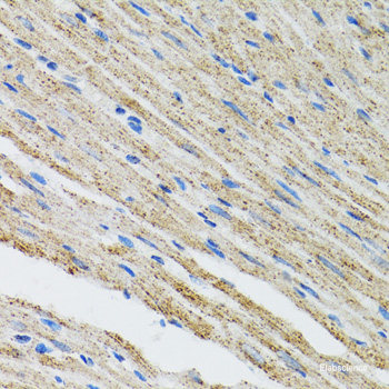 Western blot analysis of extracts of various cell lines using GATM Polyclonal Antibody at dilution of 1:1000.