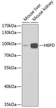 Western blot analysis of extracts of various cell lines using GBE1 Polyclonal Antibody at dilution of 1:1000.