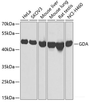 Western blot analysis of extracts of various cell lines using GDAP1 Polyclonal Antibody at dilution of 1:1000.