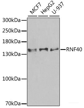 Western blot analysis of extracts of MCF-7 cells using GLRX2 Polyclonal Antibody at dilution of 1:1000.