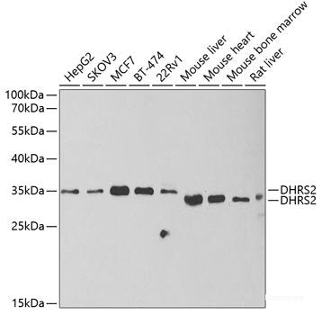 Western blot analysis of extracts of various cell lines using GPAM Polyclonal Antibody at dilution of 1:1000.