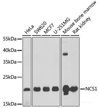 Immunohistochemistry of paraffin-embedded Mouse stomach using HPS1 Polyclonal Antibody at dilution of 1:100 (40x lens).