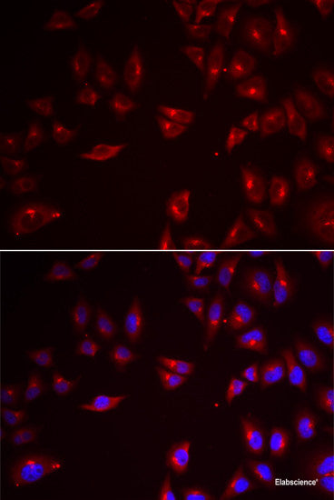 Immunohistochemistry of paraffin-embedded Rat spleen using HSPH1 Polyclonal Antibody at dilution of 1:100 (40x lens).