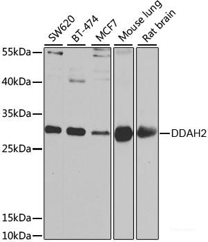 Western blot analysis of extracts of various cell lines using HYAL1 Polyclonal Antibody at dilution of 1:1000.