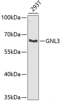 Immunohistochemistry of paraffin-embedded Human tonsil using HYOU1 Polyclonal Antibody at dilution of 1:100 (40x lens).