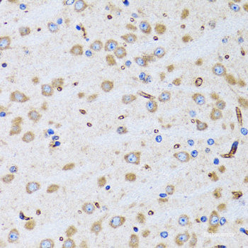 Immunohistochemistry of paraffin-embedded Rat liver using INPP5J Polyclonal Antibody at dilution of 1:100 (40x lens).