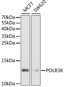 Immunohistochemistry of paraffin-embedded Human breast cancer using INTS6 Polyclonal Antibody at dilution of 1:100 (40x lens).