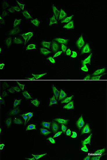 Immunofluorescence analysis of A549 cells using IRAK2 Polyclonal Antibody