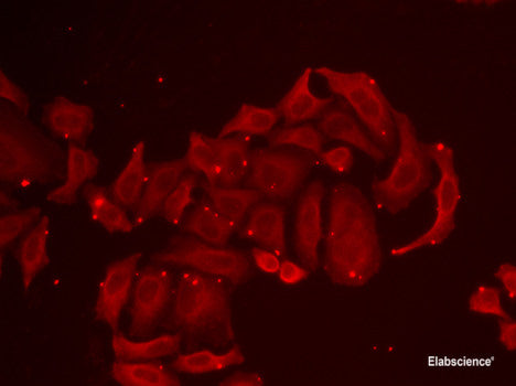 Immunohistochemistry of paraffin-embedded Mouse brain using KLK11 Polyclonal Antibody at dilution of 1:100 (40x lens).