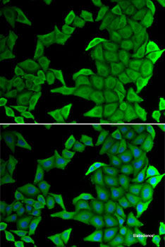 Immunofluorescence analysis of MCF7 cells using KLK4 Polyclonal Antibody