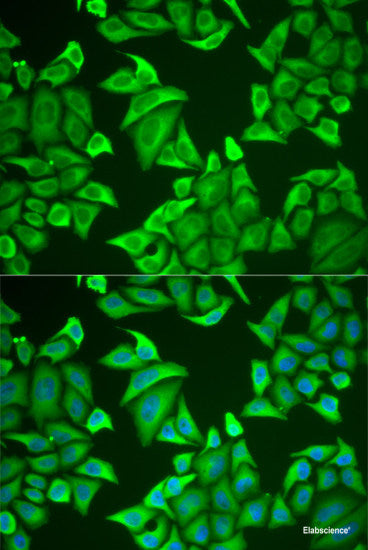 Western blot analysis of extracts of Rat testis using LRat Polyclonal Antibody at dilution of 1:1000.