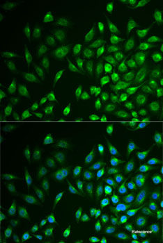 Immunofluorescence analysis of HeLa cells using MAPRE2 Polyclonal Antibody