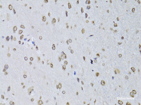 Immunohistochemistry of paraffin-embedded Rat kidney using MATK Polyclonal Antibody at dilution of 1:100 (40x lens).