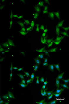 Immunohistochemistry of paraffin-embedded Rat lung using MTA3 Polyclonal Antibody at dilution of 1:100 (40x lens).