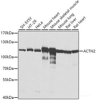 Western blot analysis of extracts of various cell lines using NUP93 Polyclonal Antibody at dilution of 1:3000.