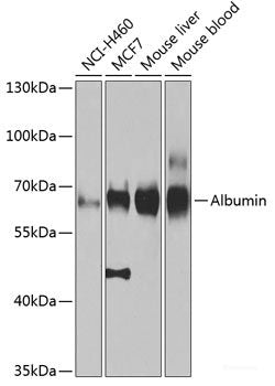 Western blot analysis of extracts of Mouse brain using NCK1 Polyclonal Antibody at dilution of 1:1000.