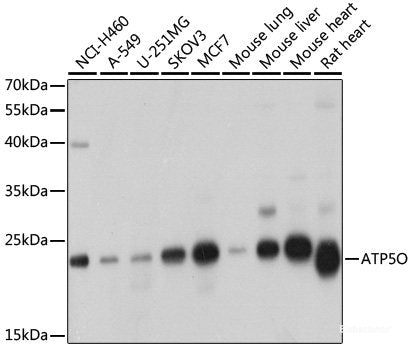 Western blot analysis of extracts of various cell lines using NDUFB5 Polyclonal Antibody at dilution of 1:1000.