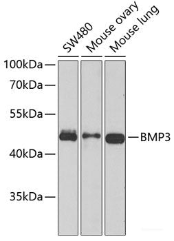 Immunohistochemistry of paraffin-embedded Human kidney cancer using DDX21 Polyclonal Antibody at dilution of 1:100 (40x lens).