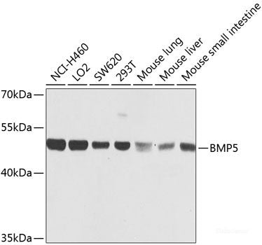 Immunohistochemistry of paraffin-embedded Human prostate using MEMO1 Polyclonal Antibody at dilution of 1:100 (40x lens).