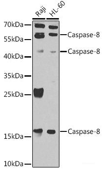 Western blot analysis of extracts of various cell lines using SOCS3 Polyclonal Antibody at dilution of 1:3000.
