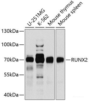 Immunofluorescence analysis of C6 cells using SETD2 Polyclonal Antibody at dilution of 1:100 (40x lens). Blue: DAPI for nuclear staining.