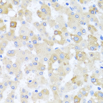 Immunohistochemistry of paraffin-embedded Human stomach using MYBBP1A Polyclonal Antibody at dilution of 1:100 (40x lens).