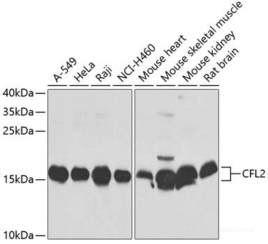 Western blot analysis of extracts of THP-1 cells using CEP55 Polyclonal Antibody at dilution of 1:1000.