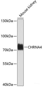 Western blot analysis of extracts of various cell lines using Caspase-3 Polyclonal Antibody at dilution of 1:1000.