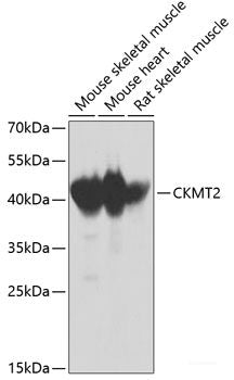 Western blot analysis of extracts of various cell lines using TLR2 Polyclonal Antibody at dilution of 1:1000.