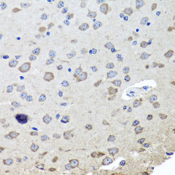 Immunofluorescence analysis of U2OS cells using Phospho-MET(Y1234) Polyclonal Antibody