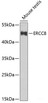Immunofluorescence analysis of U2OS cells using TRIP10 Polyclonal Antibody