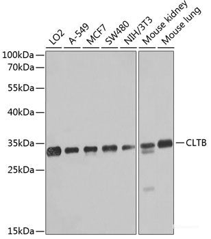 Immunohistochemistry of paraffin-embedded Human breast using BCCIP Polyclonal Antibody at dilution of 1:100 (40x lens).