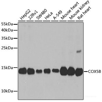 Western blot analysis of extracts of MCF-7 cells using SUMO3 Polyclonal Antibody at dilution of 1:800.