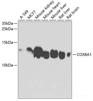 Immunohistochemistry of paraffin-embedded Rat kidney using POP4 Polyclonal Antibody at dilution of 1:100 (40x lens).