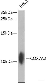 Western blot analysis of extracts of various cell lines using CEMIP Polyclonal Antibody at dilution of 1:3000.