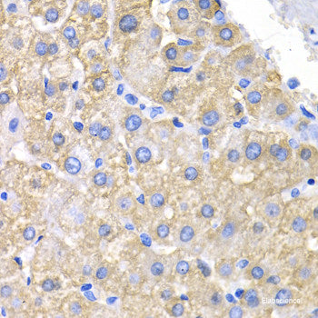 Immunohistochemistry of paraffin-embedded Rat heart using ASMT Polyclonal Antibody at dilution of 1:100 (40x lens).