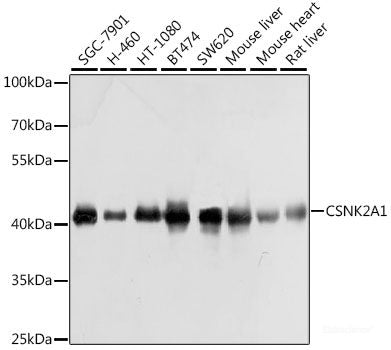Immunohistochemistry of paraffin-embedded Rat heart using COL11A1 Polyclonal Antibody at dilution of 1:100 (40x lens).
