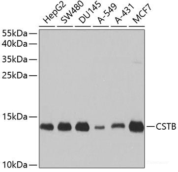 Western blot analysis of extracts of various cell lines using SLC38A3 Polyclonal Antibody.