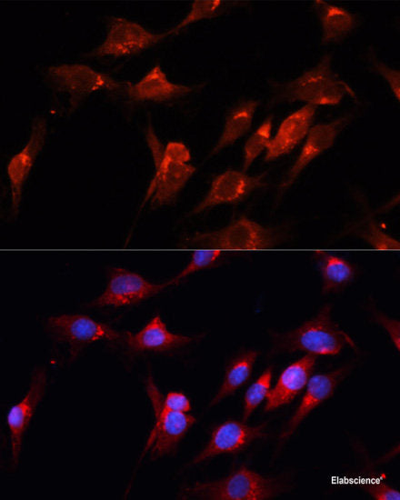 Immunofluorescence analysis of C6 cells using PLK1 Polyclonal Antibody at dilution of 1:100 (40x lens). Blue: DAPI for nuclear staining.