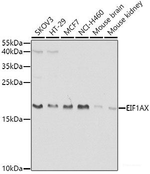Immunohistochemistry of paraffin-embedded Rat brain using GAB1 Polyclonal Antibody at dilution of 1:100 (40x lens).
