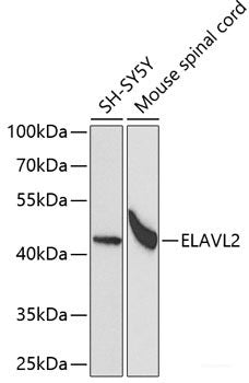 Western blot analysis of extracts of various cell lines using AOC1 Polyclonal Antibody at dilution of 1:1000.