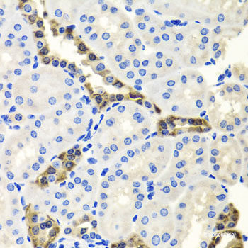 Western blot analysis of extracts of various cell lines using PCDH15 Polyclonal Antibody at dilution of 1:1000.