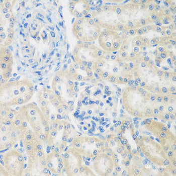 Immunofluorescence analysis of A549 cells using TRAF4 Polyclonal Antibody