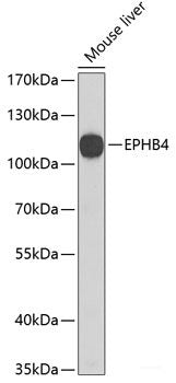 Western blot analysis of extracts of Rat pancreas using PITX1 Polyclonal Antibody at dilution of 1:3000.