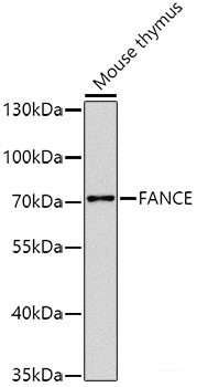 Western blot analysis of extracts of various cell lines using GATC Polyclonal Antibody at dilution of 1:1000.