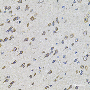 Immunohistochemistry of paraffin-embedded Mouse brain using GATA2 Polyclonal Antibody at dilution of 1:100 (40x lens).
